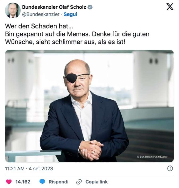 Olaf Scholz posta una foto con una benda sull'occhio dopo una caduta  facendo jogging: Aspetto di vedere i meme - Il Fatto Quotidiano