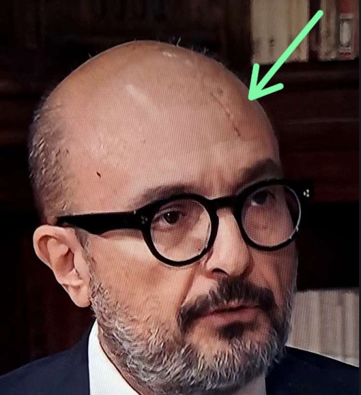 graffio in testa di sangiuliano al tg1