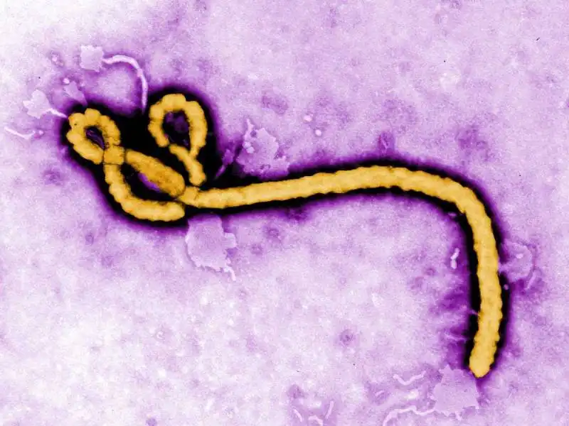 ebola virus