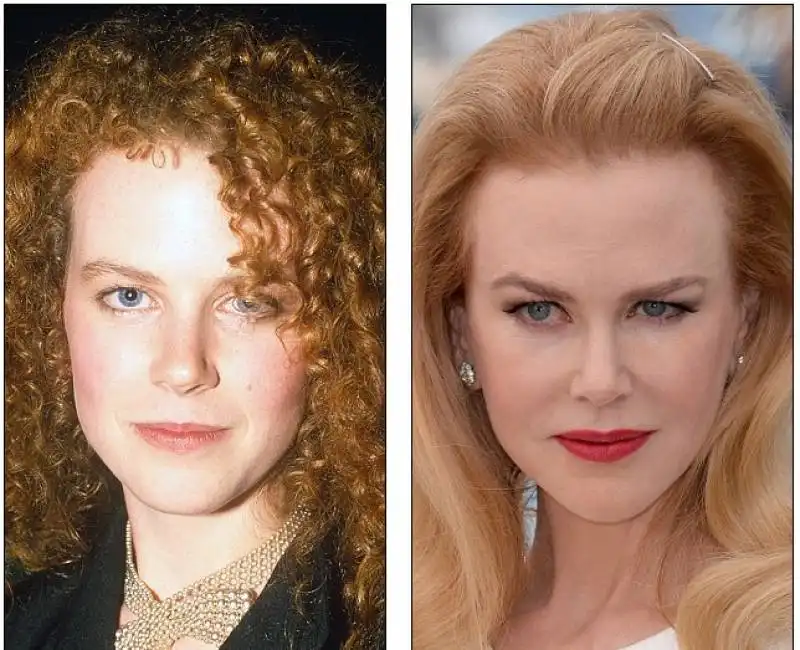 nicole kidman