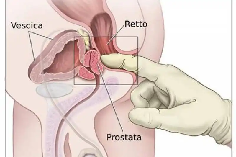 massaggio prostata