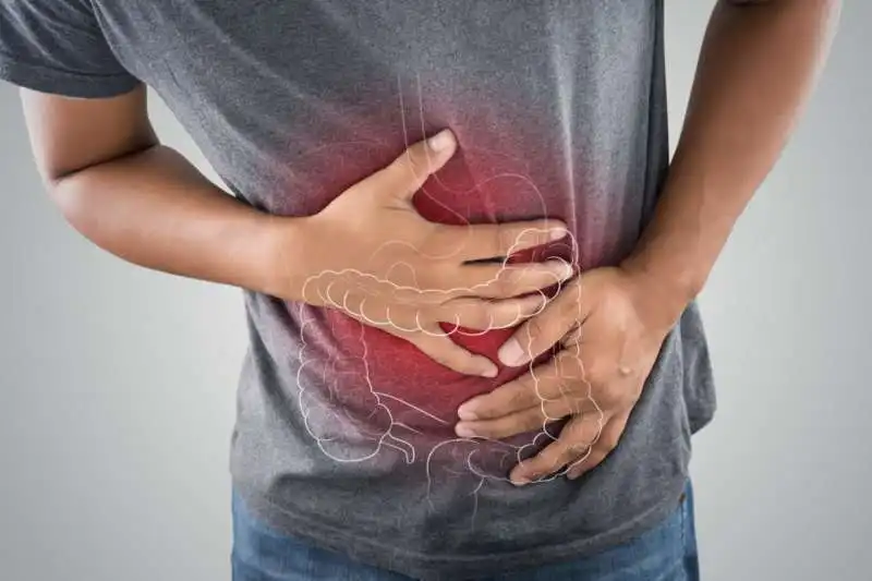 sindrome dell'intestino irritabile  3