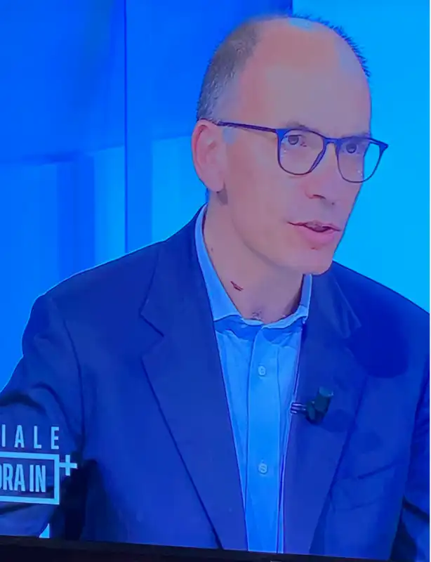 enrico letta con i tagli sopra il colletto della camicia