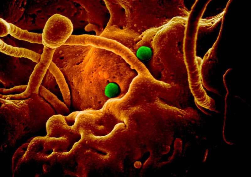 In verde particelle del coronavirus responsabile della Mers su cellule di cammello