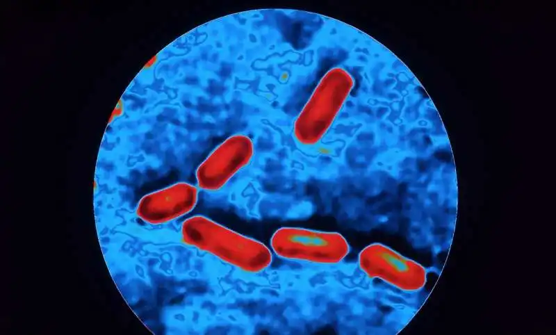 LISTERIA 