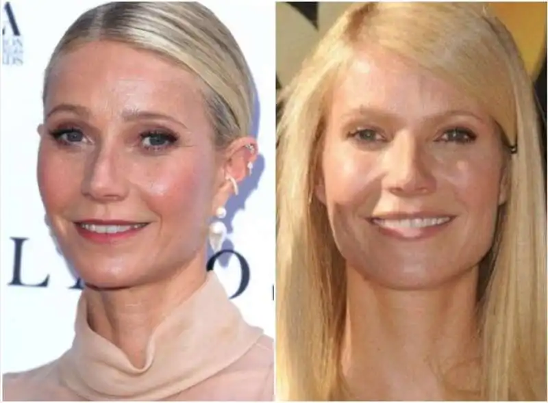 gwyneth paltrow e l botox