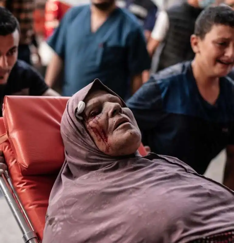 ospedali di gaza al collasso foto di motaz azaiza 3