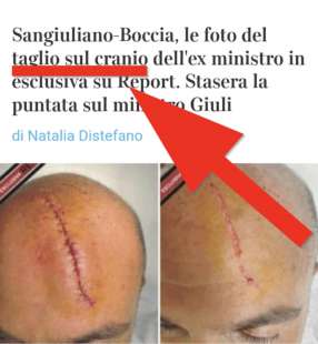 CORRIERE DELLA SERA, TAGLIO SUL CRANIO