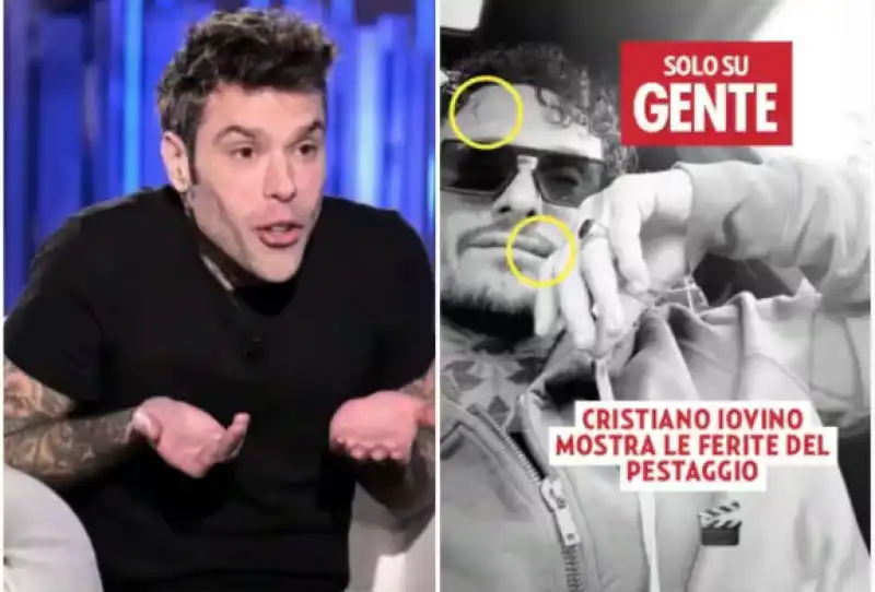 fedez cristiano iovino 