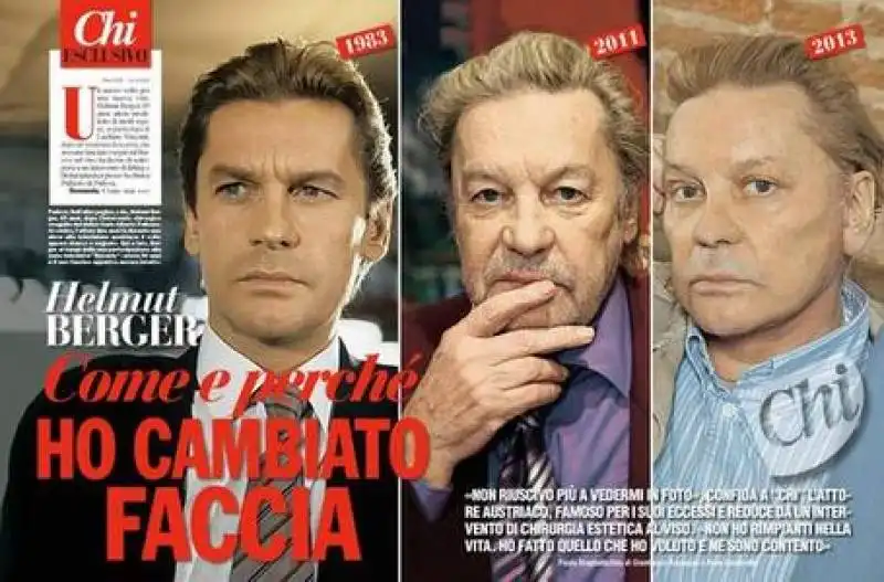 helmut berger plastica facciale