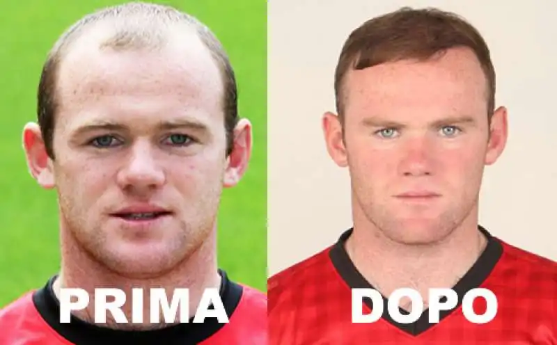 ROONEY