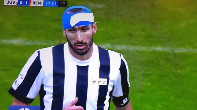 Chiellini