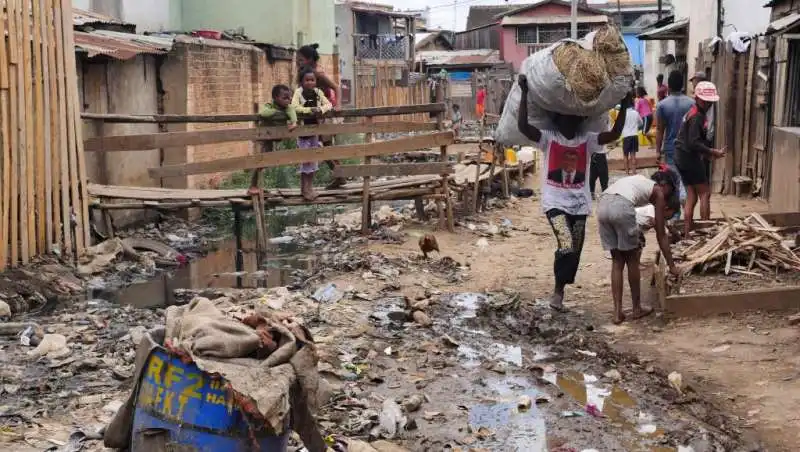 MADAGASCAR - EPIDEMIA DI PESTE