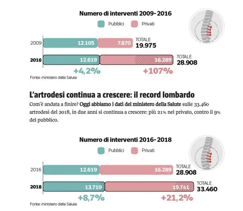 numero di interventi   mal di schiena