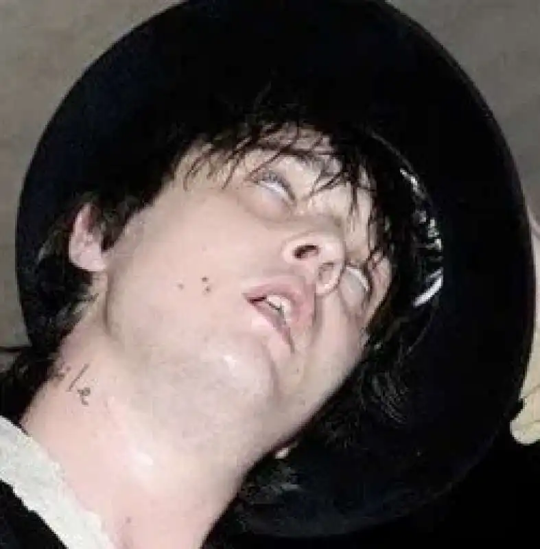 pete doherty 11