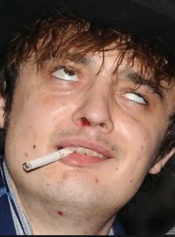 pete doherty 9