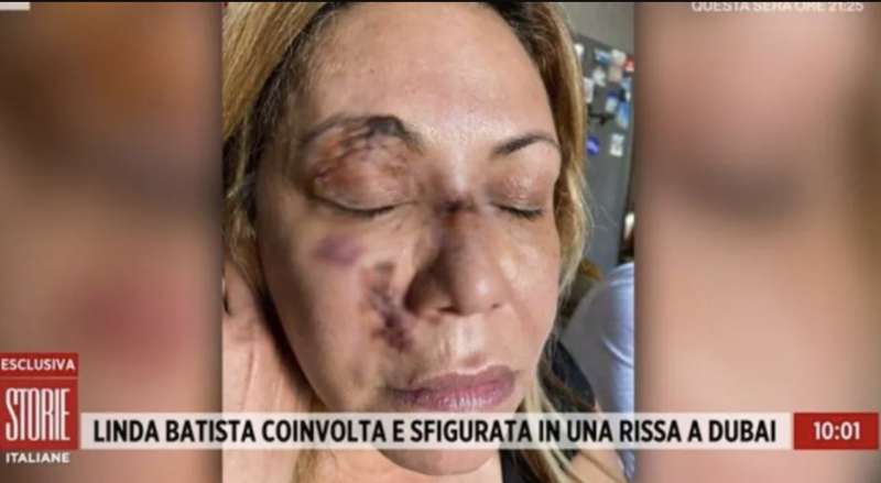 linda batista aggredita a dubai