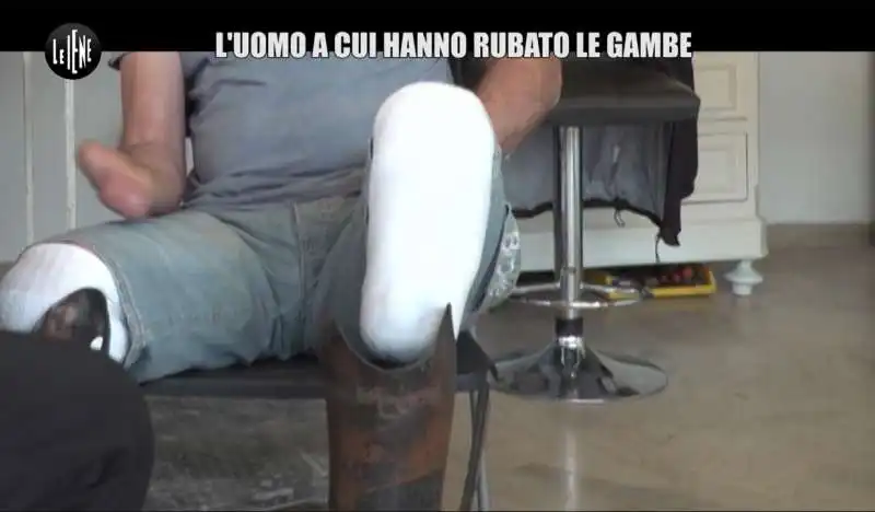 iene servizio  uomo che ha rubato le gambe 5