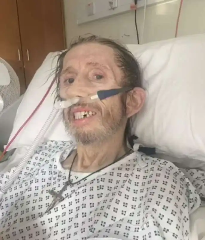 shane macgowan in ospedale 