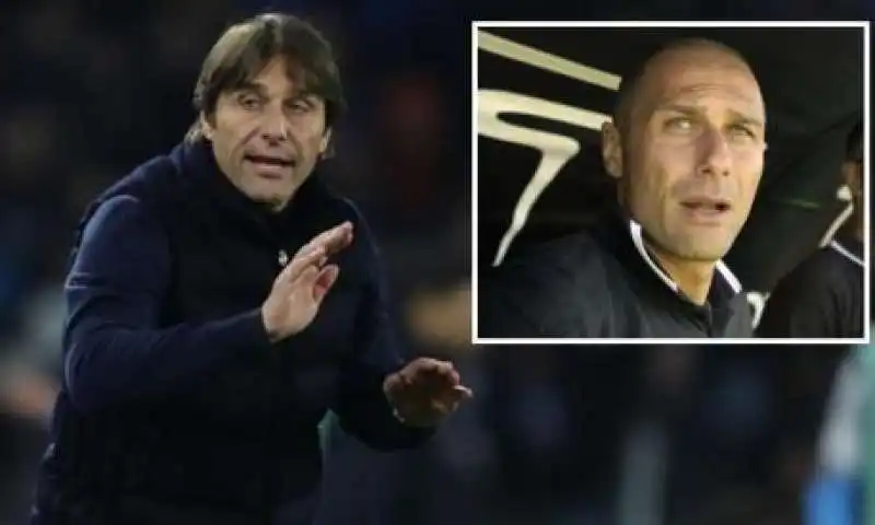 antonio conte trapianto di capelli