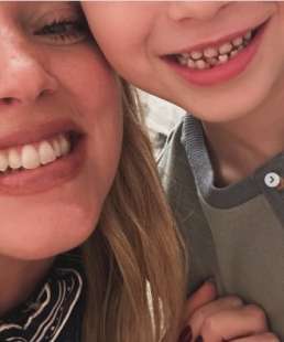 chiara ferragni e la mancetta per il figlio per la caduta del dentino 1