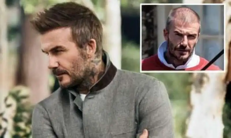 david beckham trapianto di capelli