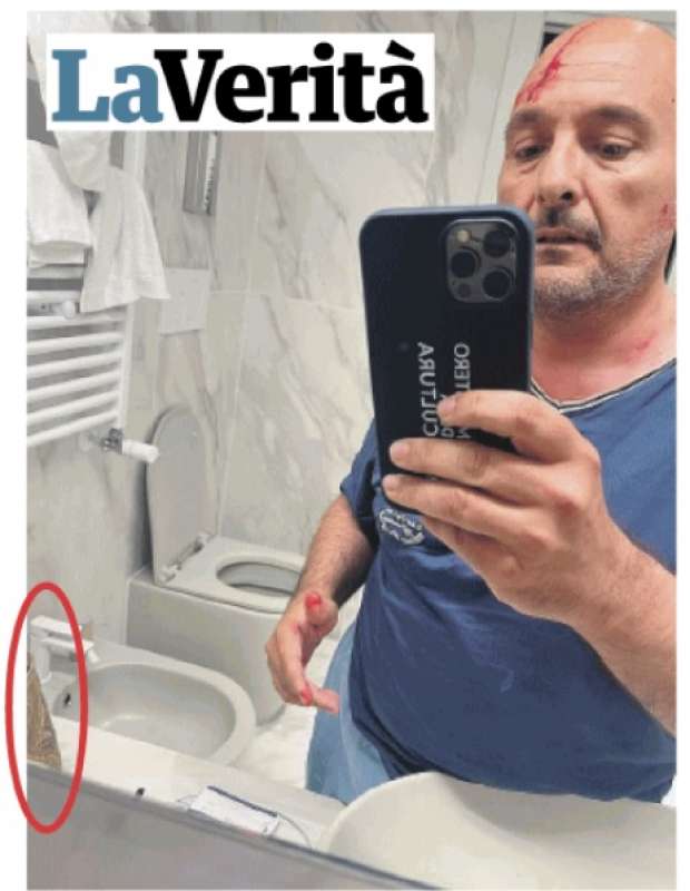 IL SELFIE IN BAGNO DI GENNARO SANGIULIANO CON LA FERITA IN TESTA ANCORA APERTA - FOTO LA VERITA