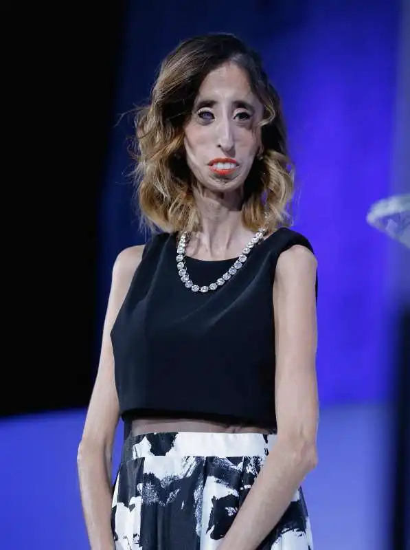 LIZZIE   VELASQUEZ