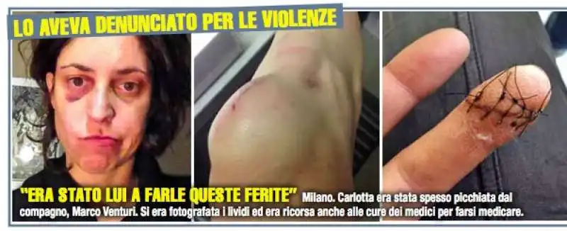 carlotta benusiglio e le violenze subite