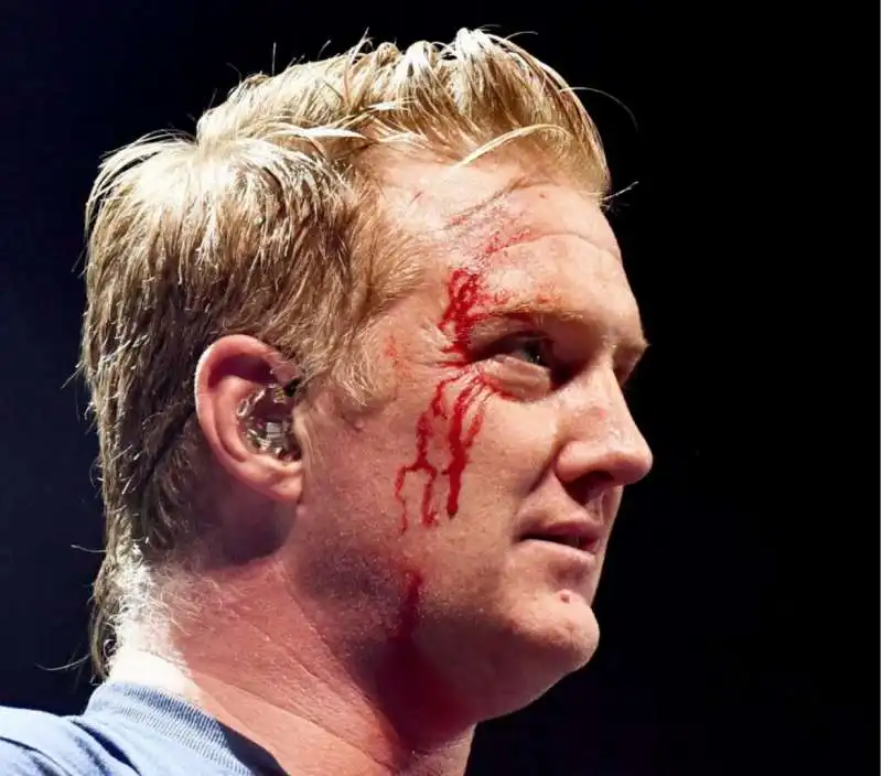 josh homme insanguinato