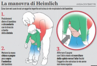 la manovra di heimlich