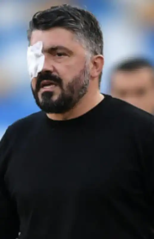 GATTUSO