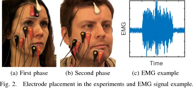 facial surface electromyography