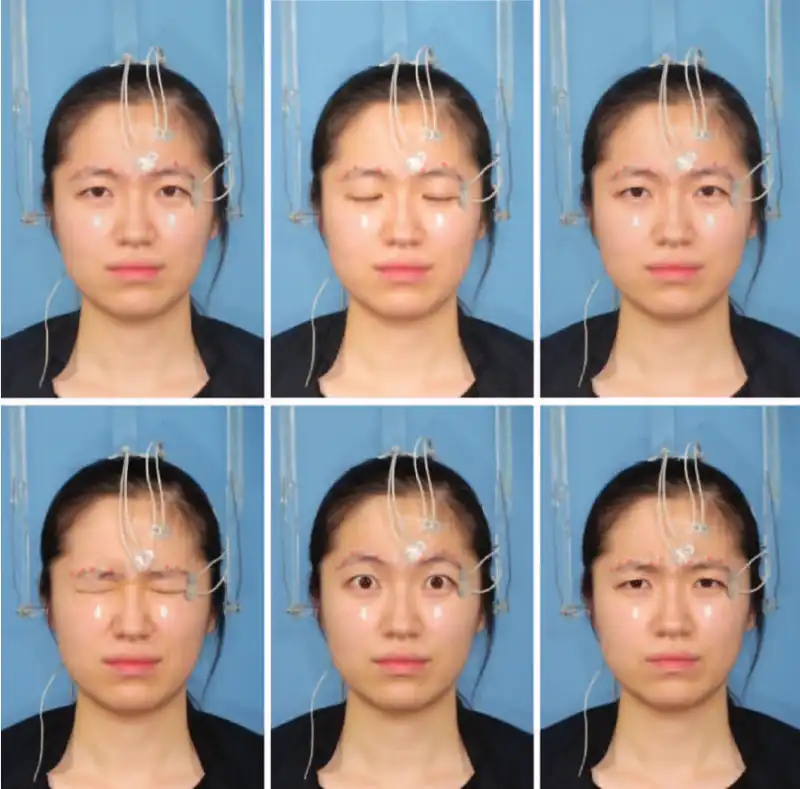 facial surface electromyography 3