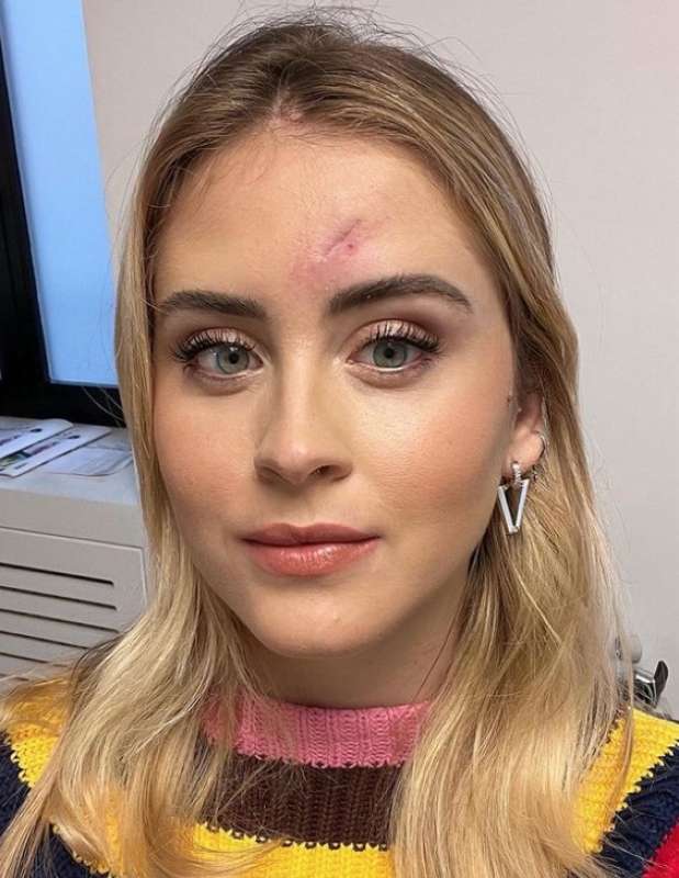 valentina ferragni e il carcinoma 6