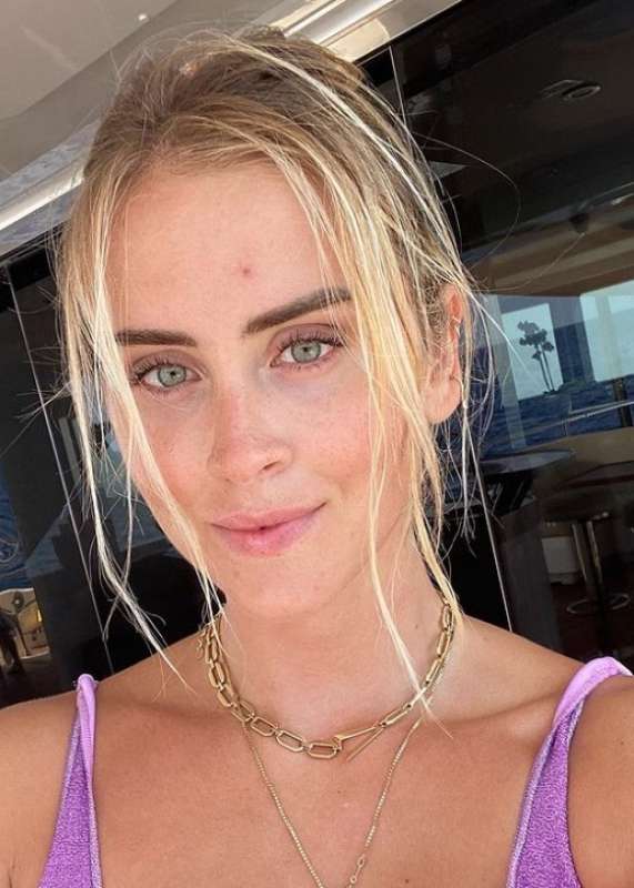 valentina ferragni e il carcinoma 8