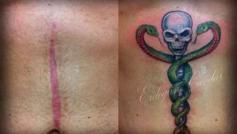 tatuaggi per coprire cicatrici 3