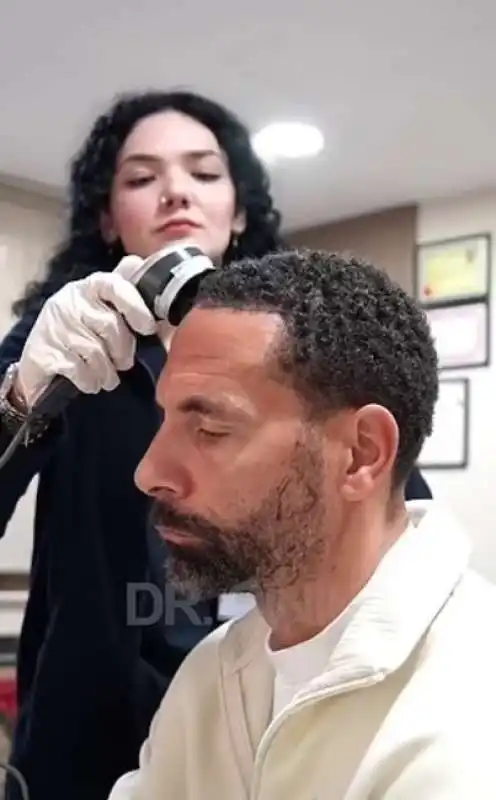 rio ferdinand trapianto di capelli 