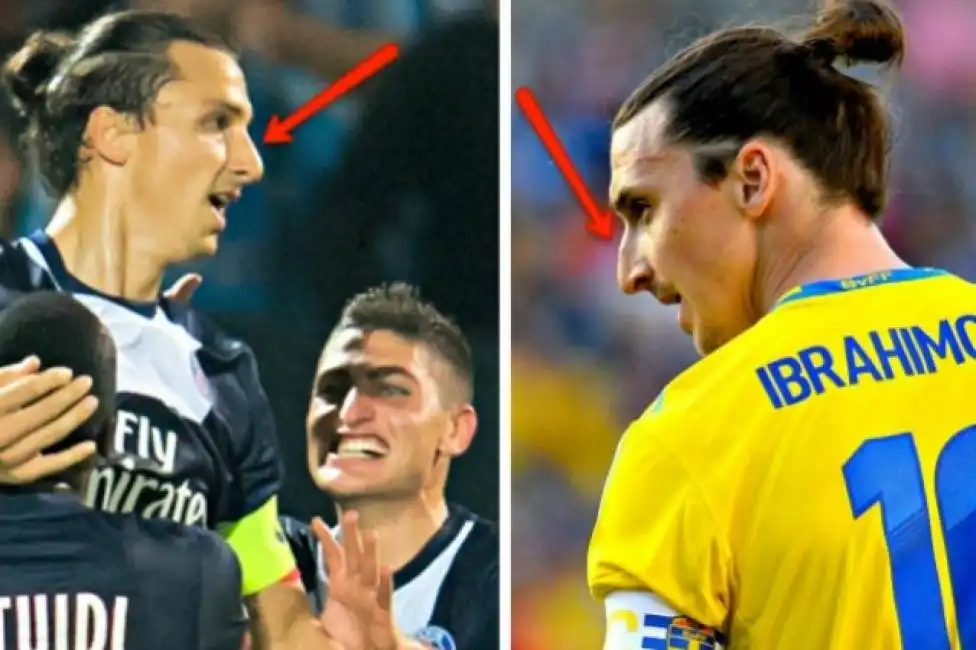 ibra