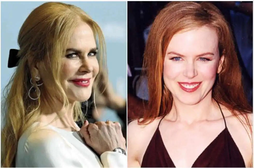 nicole kidman