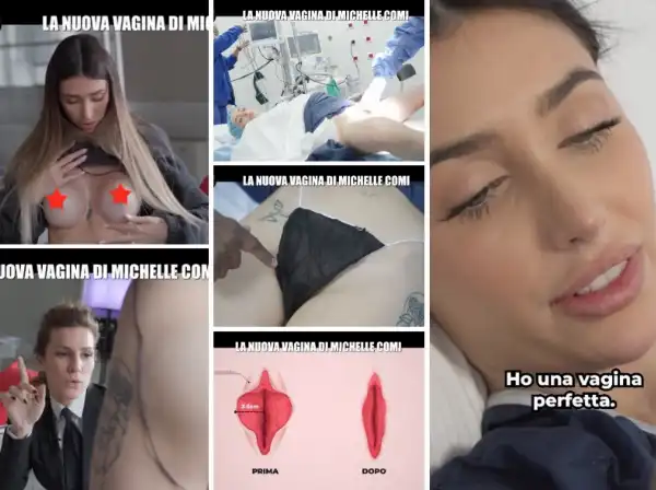 michelle comi vaginoplastica vagina labioplastica 