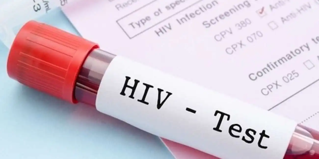 hiv test 