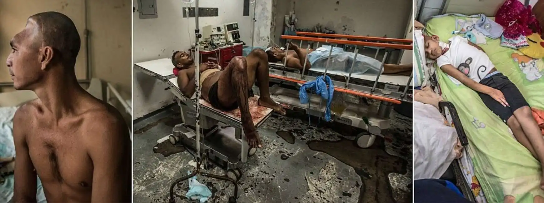 venezuela ospedali