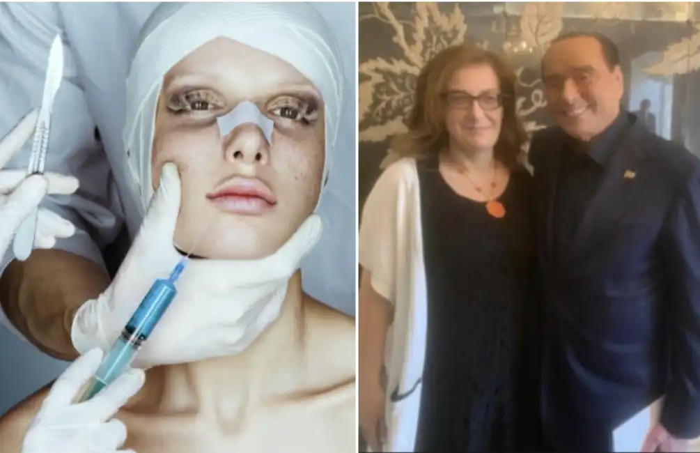 chirurgia estetica annarita patriarca silvio berlusconi botox