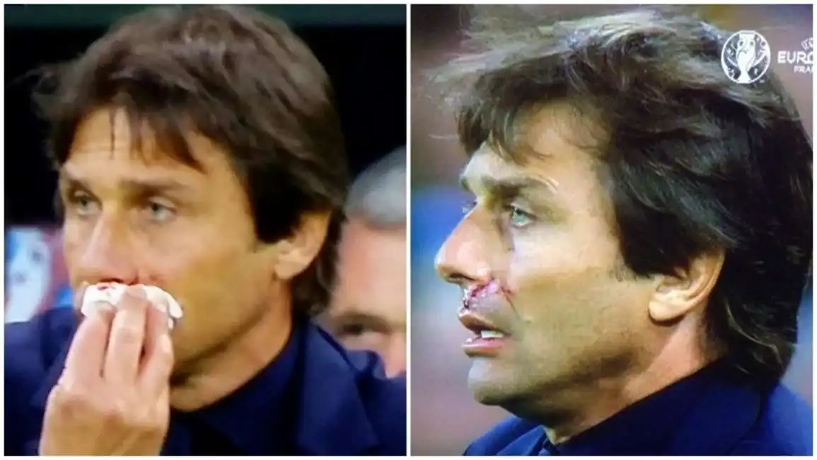 antonio conte sangue post-gol -1