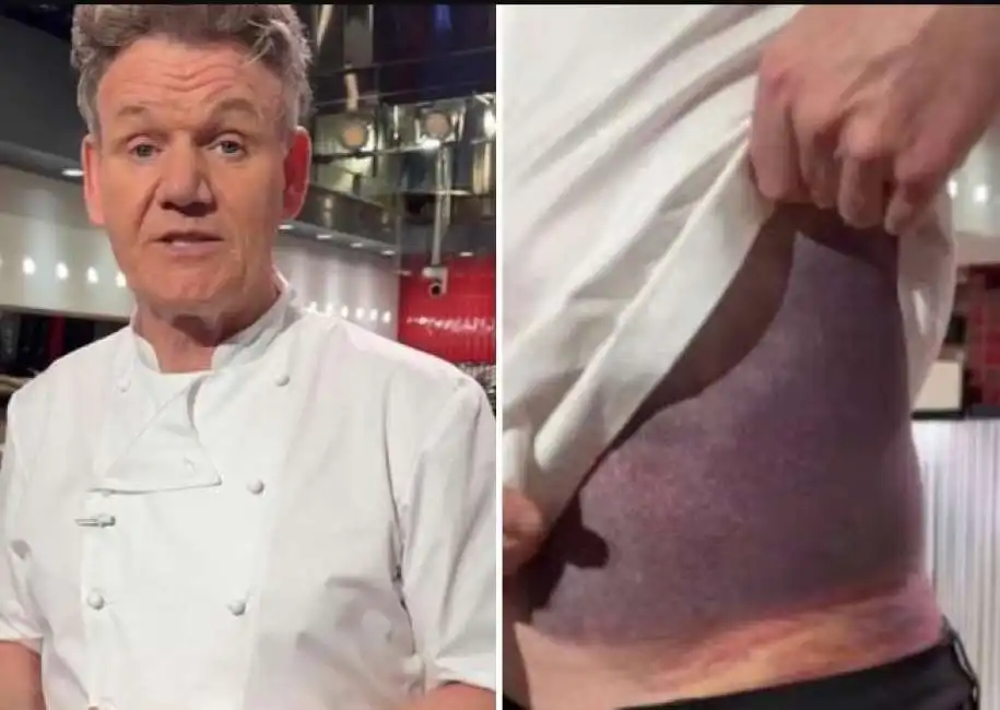 incidente in bici per gordon ramsay