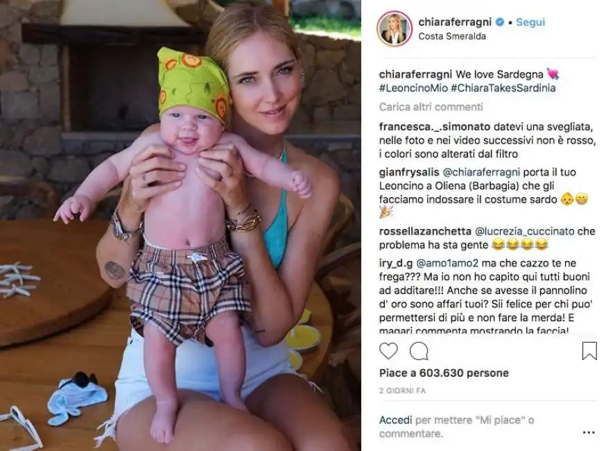 chiara ferragni e il figlio leone con la pelle arrossata