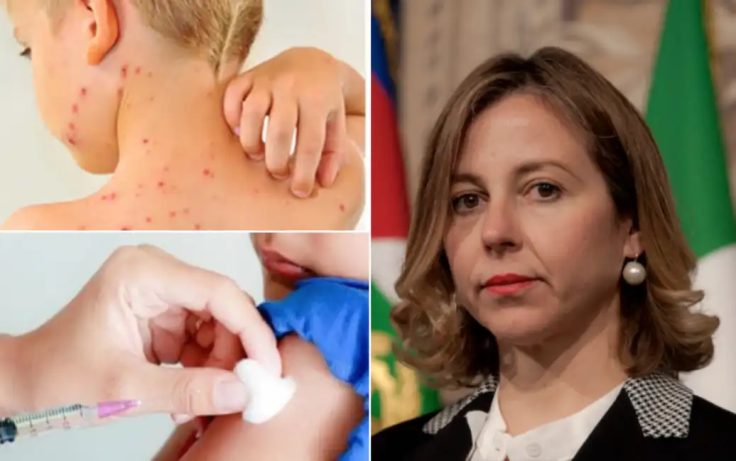 grillo vaccini morbillo