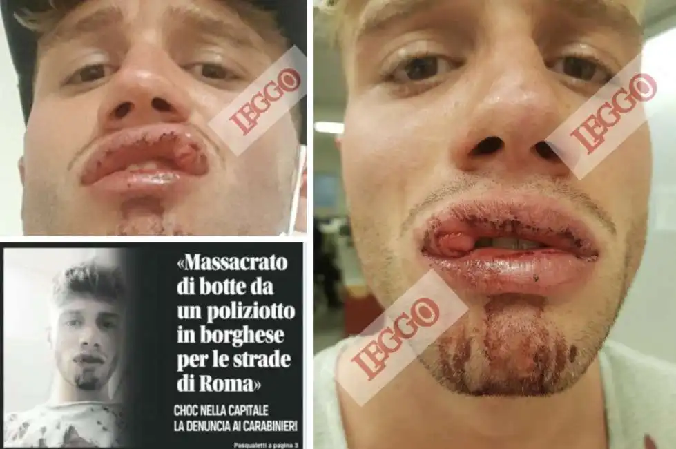 marco ragazzo polizia roma botte sangue 