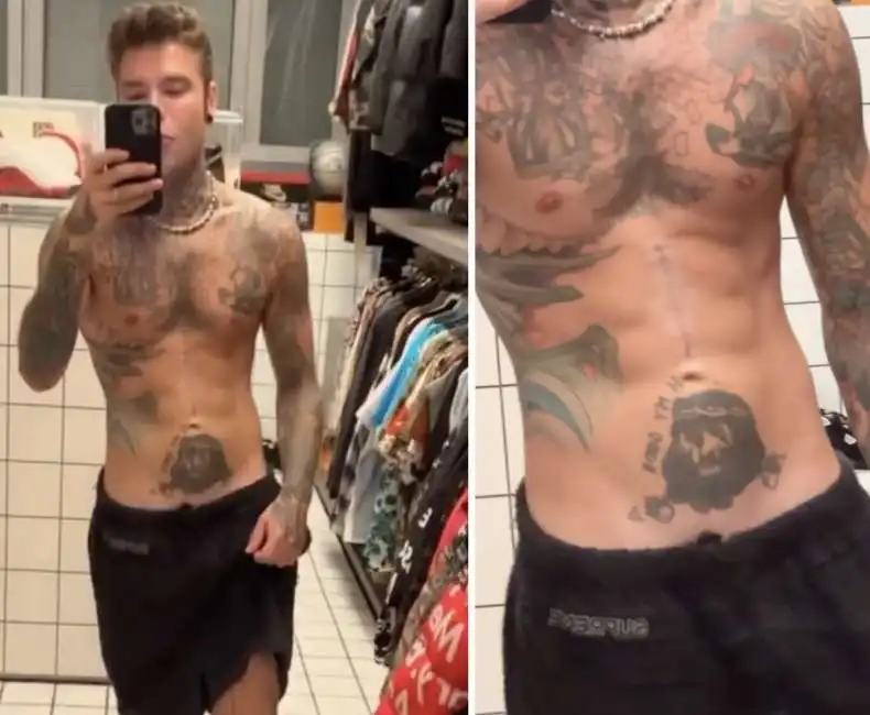 fedez micropene pancia cicatrice 